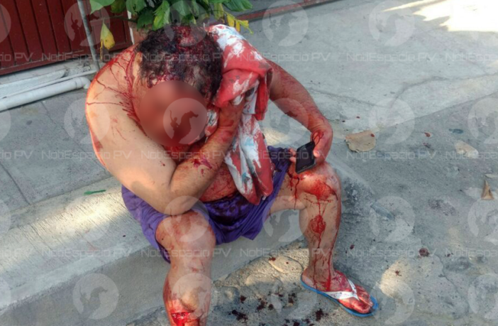 Noticias de Puerto Vallarta | NotiespacioPV | Joven navajea a su padre