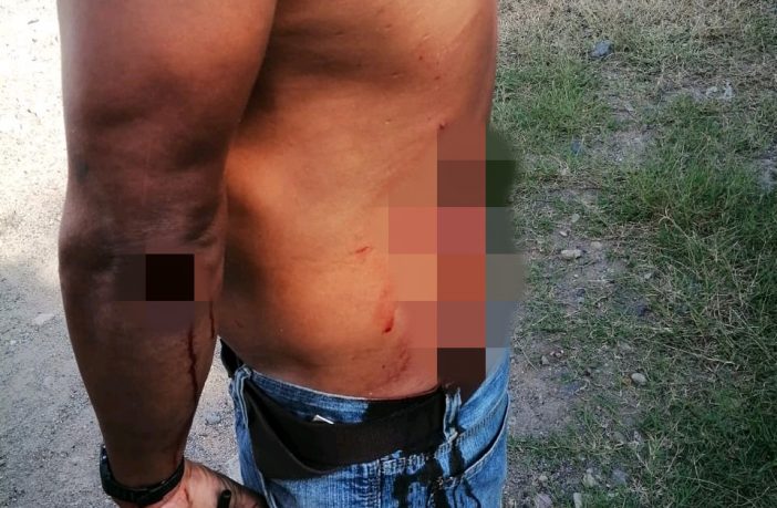 Noticias de Puerto Vallarta | NotiespacioPV | Mujer agrede a cuchillazos a marido en Ixtapa