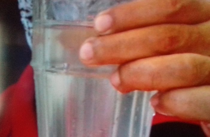 Noticias de Puerto Vallarta | NotiespacioPV | Agua contaminada afecta la salud de los jaliscienses