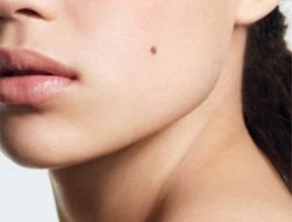 Noticias de Puerto Vallarta | NotiespacioPV | Covid-19, afecta también a otros órganos como la piel, dermatólogo UNAM