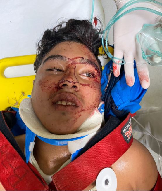 Noticias de Puerto Vallarta | NotiespacioPV | Urge localizar a los familiares de este joven accidentado