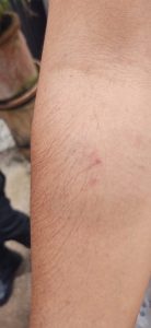 Noticias de Puerto Vallarta | NotiespacioPV | A mordidas, mujer agrede a su ex pareja en Playa Grande