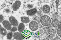 Notiespacio PV | Confirma la OMS 80 casos de viruela del mono en 11 paìses