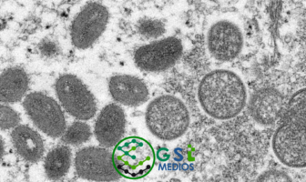 Noticias de Puerto Vallarta | NotiespacioPV | Confirma la OMS 80 casos de viruela del mono en 11 paìses