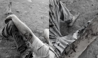 Notiespacio PV | Perros Pitbull atacan a hombre en Villa Las Flores