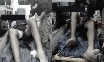 Notiespacio PV | Riña en Banus deja un lesionado de gravedad