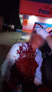 Se le atraviesa poste a conductor y termina con serias lesiones en Las Juntas