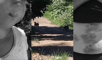 Vecinos de Loma Bonita piden a las autoridades actuar contra perros pitbull que atacaron a una mujer Vecinos de Loma Bonita piden a las autoridades actuar contra perros pitbull que atacaron a una mujer