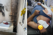 Un lesionado por 'flamazo' en fraccionamiento Altavela, Bahía de Banderas