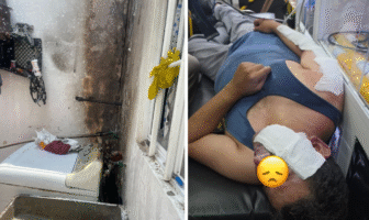 Un lesionado por 'flamazo' en fraccionamiento Altavela, Bahía de Banderas