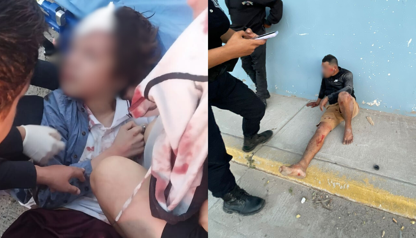 Atropellan a menor en Av. Los Poetas; conductor queda bajo custodia