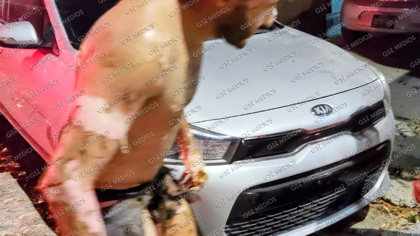 Explosión por acumulación de gas en Los Portales deja un hombre con quemaduras graves Explosión por acumulación de gas en Los Portales deja un hombre con quemaduras graves